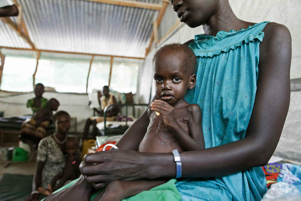 Read more about the article UNICEF: 200 millioner børn på verdensplan lider af fejlernæring