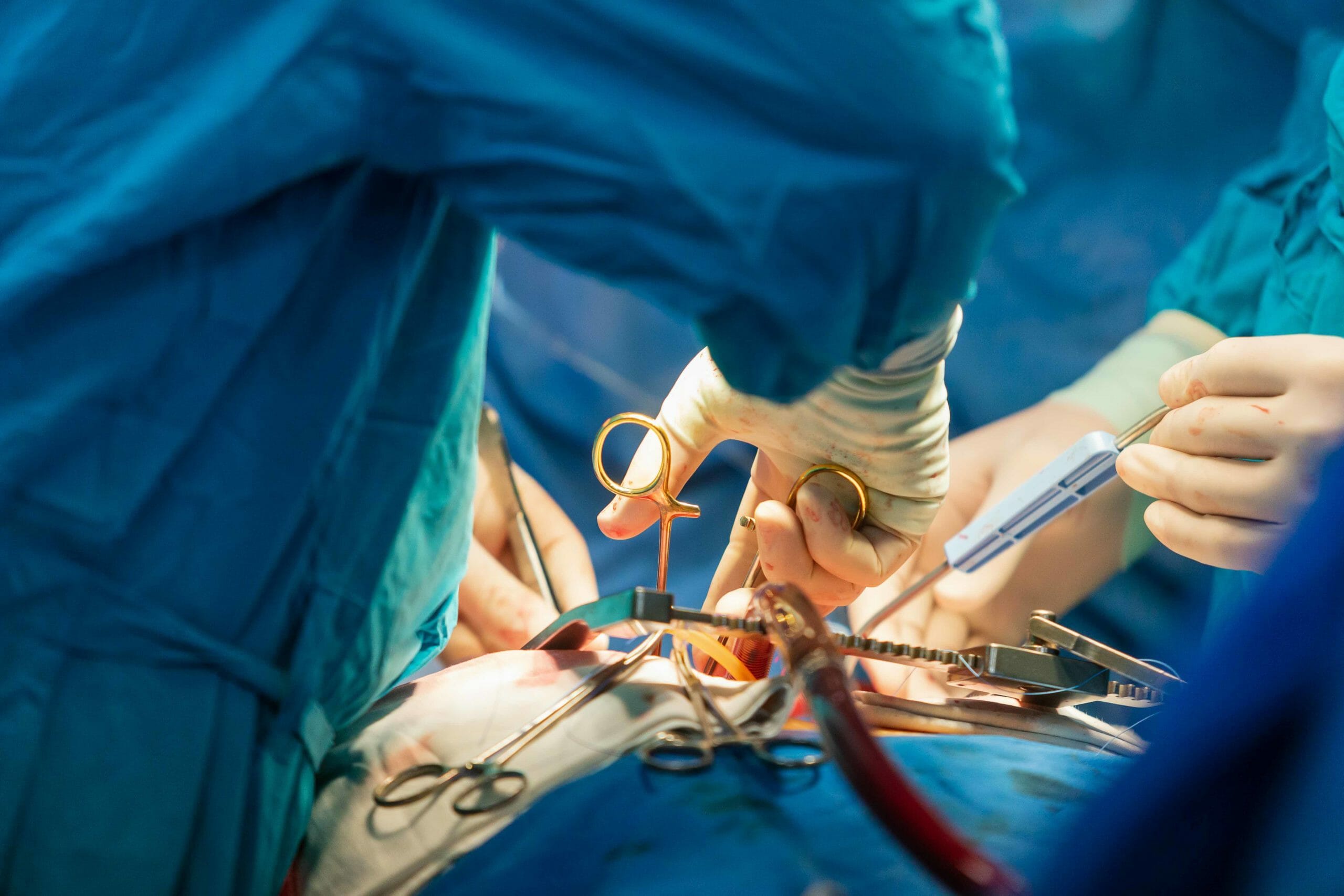 Read more about the article Flertal lover at finde løsning men afviser automatisk organdonation